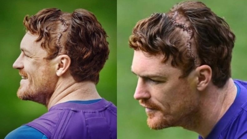 Garyrohan