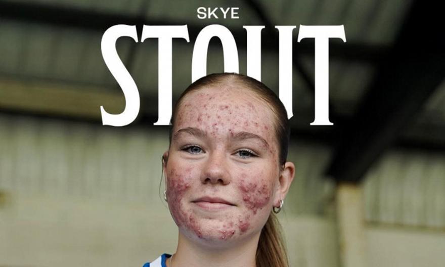Skott 164719